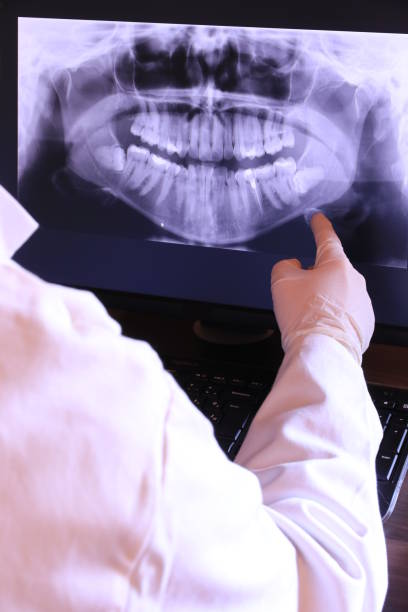 Best Knocked-Out Tooth (Avulsed Tooth) Treatment in Remgton, IN